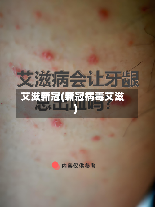 艾滋新冠(新冠病毒艾滋)