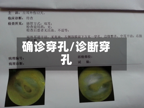 确诊穿孔/诊断穿孔-第3张图片